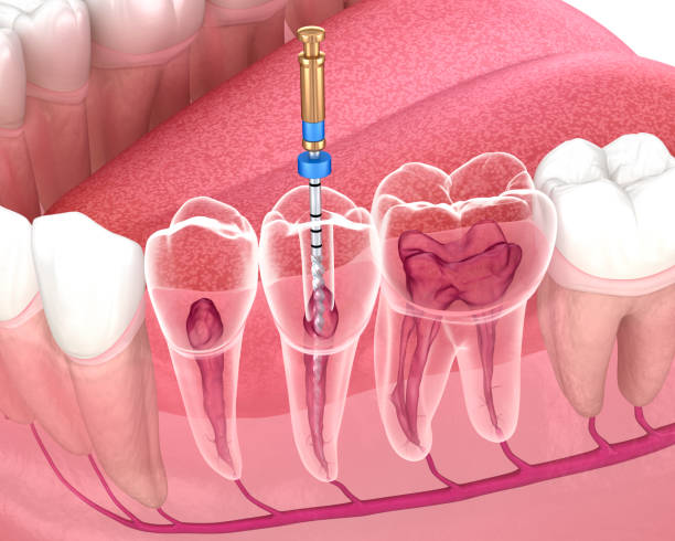 Endodontia