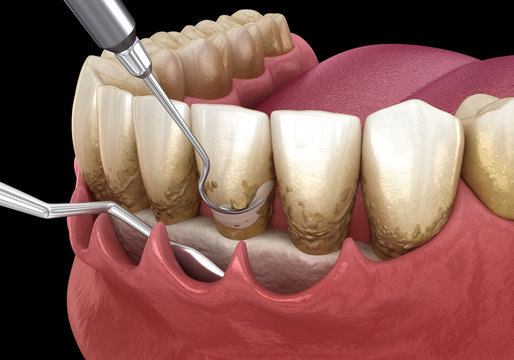Periodontia